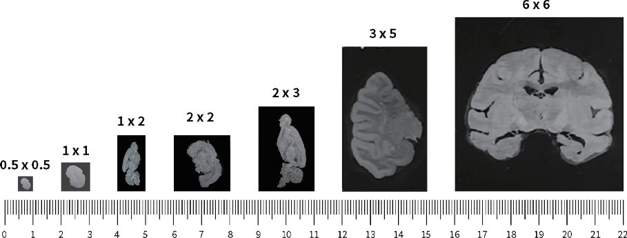 Figure 1. Stereo-seq captures DNA Nanoballs (DNBs) arranged at single-cell resolution, enabling mRNA from individual cells to be detected with hundreds of DNBs, each carrying a unique Coordinate ID (CID).